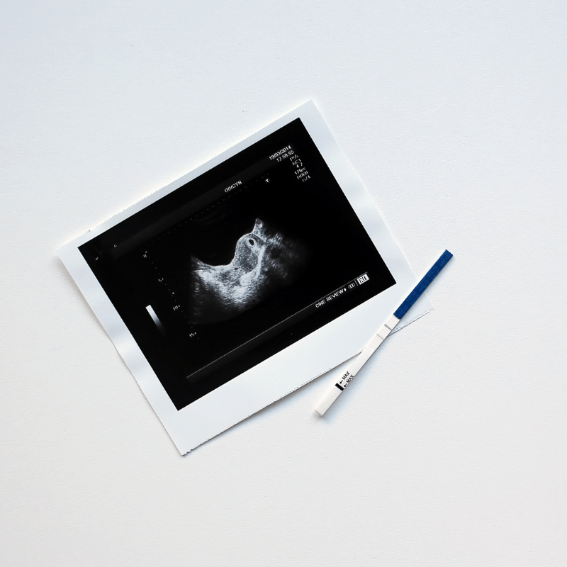 zwangerschapstest kopen