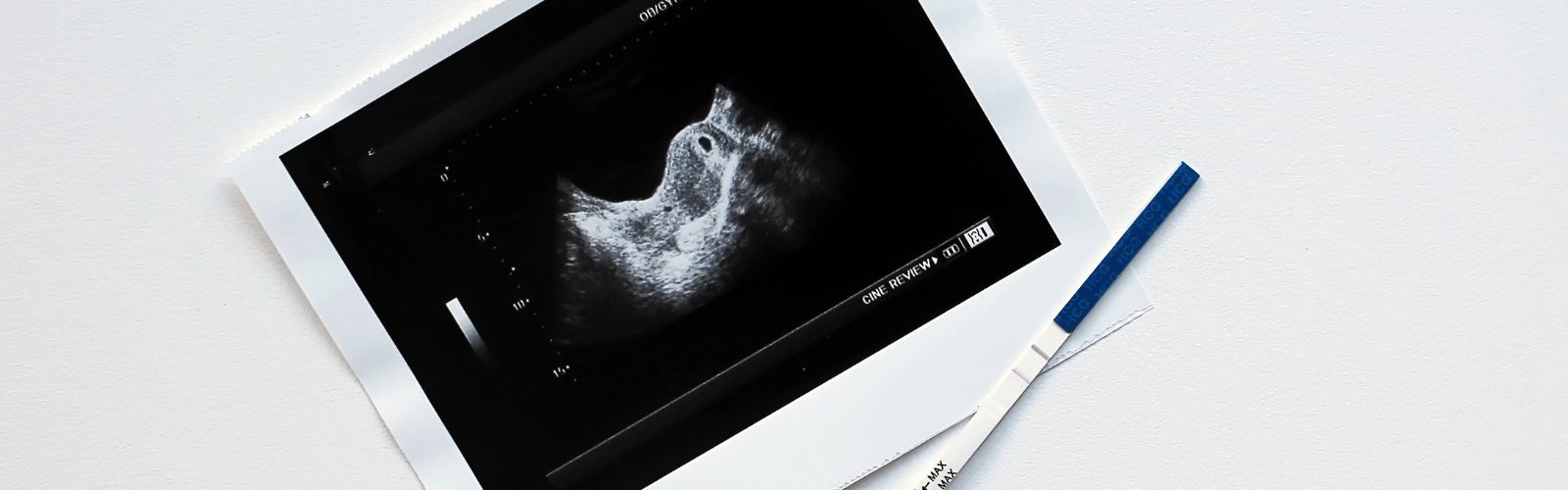 zwangerschapstest kopen