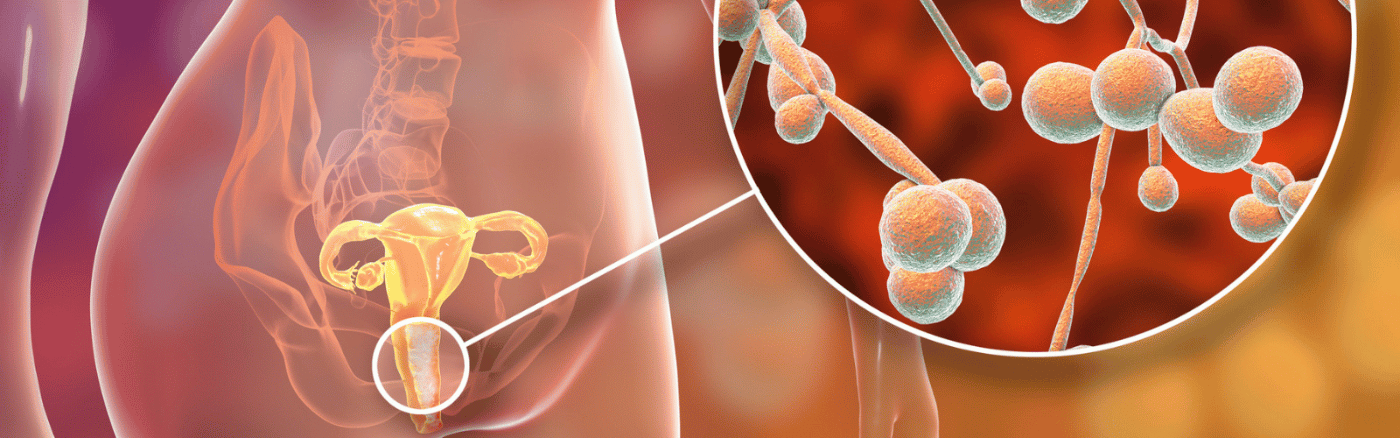 medicijnen schimmelinfectie