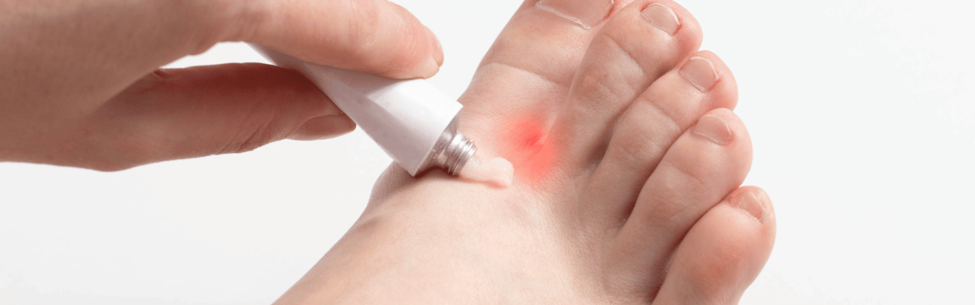 medicijnen schimmelinfectie